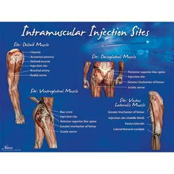 Intramuscular Injection Sites Poster