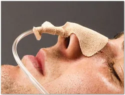 DALEÂ® NASOGASTRIC TUBE HOLDERS, EA